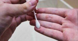 Удаление бородавок эфирными маслами 8 60b7853ebf714